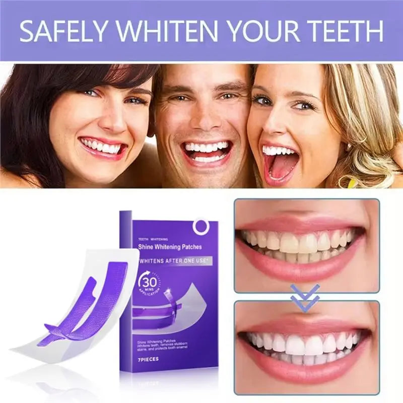 Teeth Whitening Strips